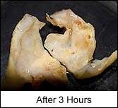 artery after treatment